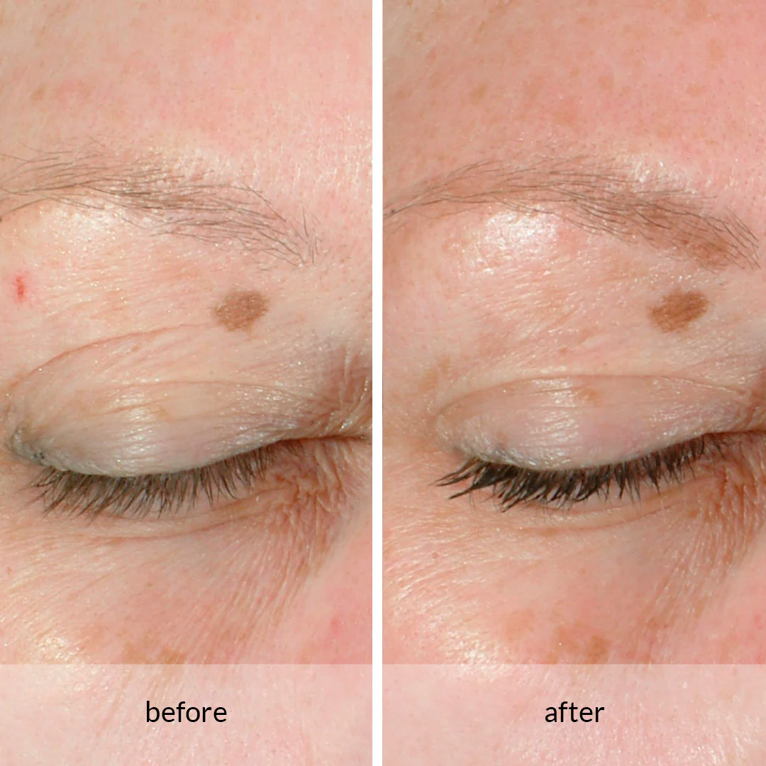 Anew Platinum Lift & Tighten Dual Eye System - Image 3