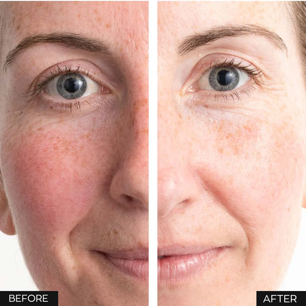 Anew Skin Renewal Power Serum - 30ml - Image 8