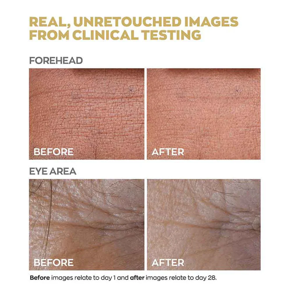 Anew Reversalist Mini Gift Set - Image 7